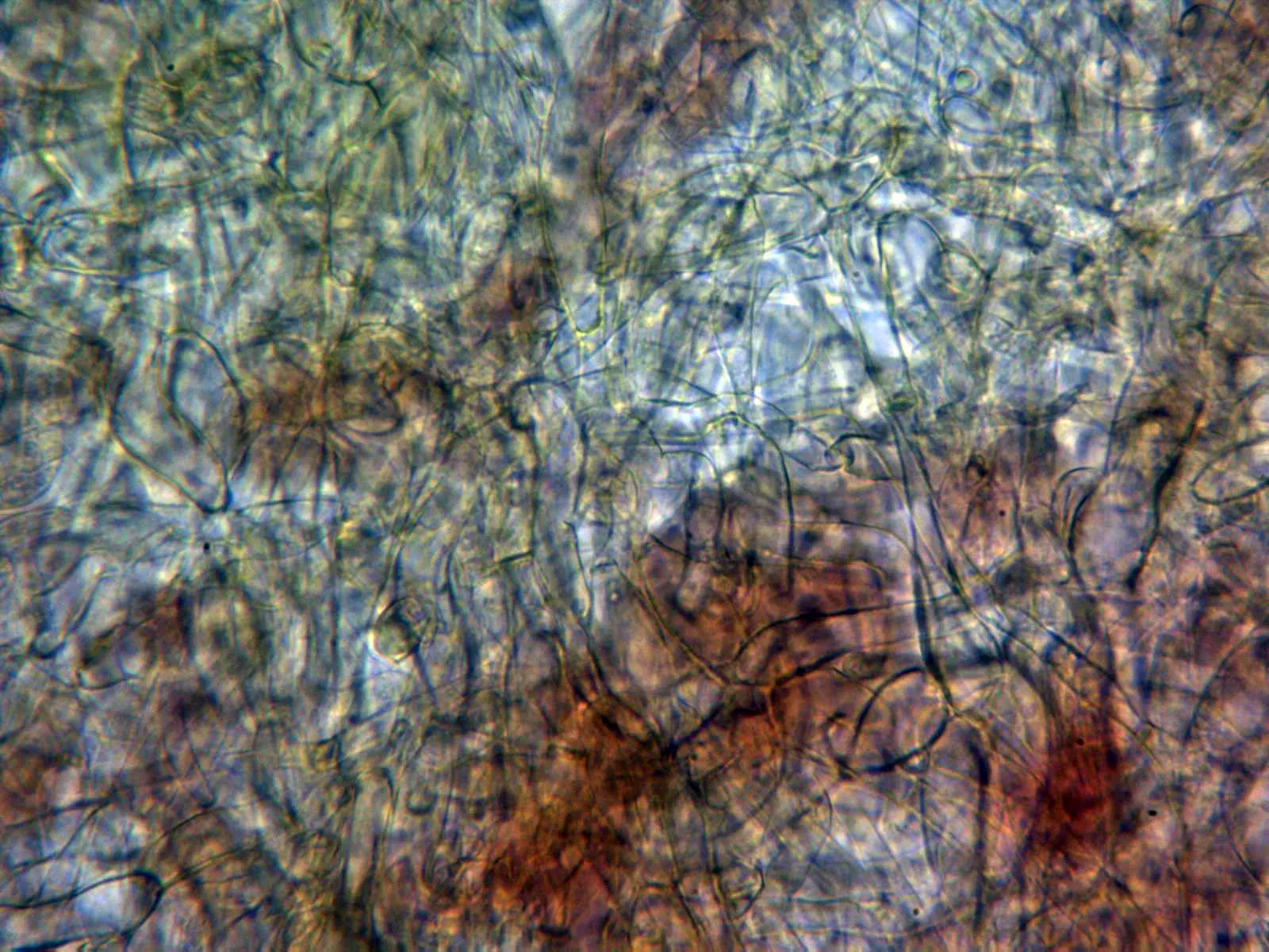 Microscopía de Otidea formicarum - 6 - Excípulo medular x 400